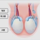 남자로 태어나 딱 한번 하는 수술 정관수술