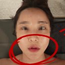 끌레르보떼에스테틱 | 여의도 피부관리 에스테틱 에서 달팡 얼굴라인 정리 받고왔어요 끌레르보떼 후기
