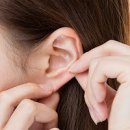 귓볼 주름 귀 주름과 치매 전조증상 관련성은 무엇일까? 이미지