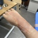 한강수성형외과의원 네이버블로그