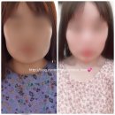 브릴랑스킨 | [광주피부관리] 브릴랑 : 부잣집 막내딸 기분이 이런걸까요 ❓ 브릴랑 상세후기 ⭐💚😆