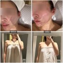 태영이불 | 의정부 여드름 압출 잘하는 스킨데이 피부관리실 (비립종, 좁쌀케어)