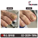레푸스 망우점