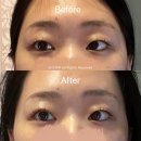 하얀 피부 | 강서구 에스테틱 하얀피부 후기 동안 만드는 윤곽관리 중안부 짧아지기
