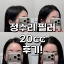 20 | 신사역피부과 두상필러 잘하는곳 20cc 후기