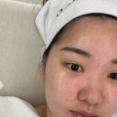 광주 피부관리샵 찾아갔던 에스테틱 실제 받은 후기