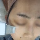 5994 | 검단 김포 주근깨 기미관리 잘하는 피부관리샵 솔찍후기 총정리