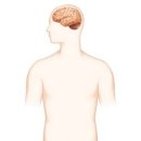 노인성 치매 senile dementia정의 이미지