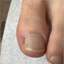 구로-구로-구로-766 | 구로 영등포 내성발톱 관리 2026 상반기 제일 잘한 선택 오벨리네일푸스 족보있는그녀들 금천점