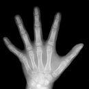 키클아이 이미지