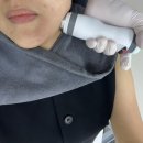 신사역 피부과 이뻐 타이탄 패키지로 이중턱 개선 후기