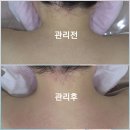 영등포 바디관리 샤인에스테틱 등관리 라운드숄더 솔직 후기