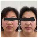 (주)다온메디칼 | 오산바디관리/오산대역바디관리/💡 “톡시온 사독관리 – 실제 후기 &amp; Before/After 사진 공개