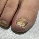 매료네일 문제성전문점 이미지