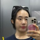 압구정 피부과 애교살 필러 수입산 한달 후기 부작용 붓기