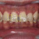 서울산성플란트치과의원 이미지