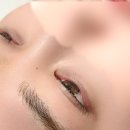 담트