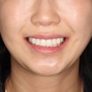 블랑쉬랩 이미지