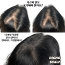디그노스칼프