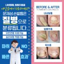 검단더굿정형외과의원 네이버블로그