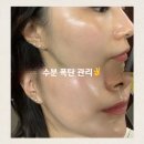 부산 연산동 시청 근처 에스테틱 “서연뷰티”예민.홍조.아픈피부ㆍ문제성피부엔 LDM물방울리프팅 케어