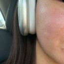 리즈 | 광고아님) 내돈내산 스킨부스터 리쥬란 , 리즈네 , 셀르디엠 후기!!