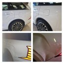 이강양한방병원 | [충남 아산] 교통사고 100:0 무보험사고 - 레메디 한방병원 진료 입원 치료 기록 후기