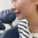 라미치과의원 | 라미네이트 후기, 뉴엔치과에서 자연스럽게 바뀐 느낌! ✨