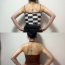 팔뚝살지방흡입 가격 송도 후기 / 붓기 / 2개월차 사진