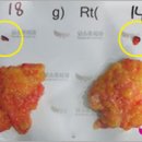 부유방 제거 수술 부유방 통증 부유방 겨드랑이 팔뚝 부유방 자가 진단 이미지