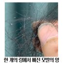 부천 남자 탈모, 벗어나고 싶지 않으면 이 글을 읽지 마세요.