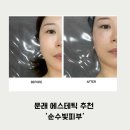 순수피부 | 문래동 에스테틱 꼼꼼한 맞춤관리‘순수빛피부’ 솔직후기!