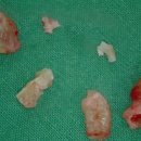 서울사랑니안녕치과의원 이미지