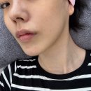 헬리오스 | 헬리오스 5G 토닝 기미 주사 후기