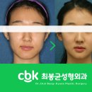 윤곽