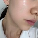 울쎄라 효과 시술 후 관리법??｜AI메타스캔 피부진단부터 한 달 후 변화까지