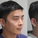 디테일의원 이미지