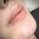 05.산동사거리B | 월곡역왁싱 후기 | 민감피부도 트러블 나지 않게 받은 인중 슈가링왁싱: &lt;하이업&gt;