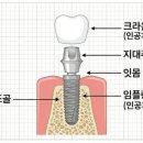 아치치과기공소 이미지