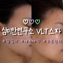 왕십리 피부관리 심미안연구소 VLT스파 페이스쿨 홍조관리 솔직후기