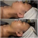 광주광역시 남구 월산동 주민센터 회의실 | 나주에서 광주 월산동 차느에스테틱 다녀온 솔직 리얼후기(쌩얼주의)