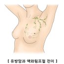 유방암(서울대 병원 및 서울아산병원) 이미지