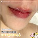 이대피부관리 데콜테+립볼륨케어 더숲에스테틱 만족후기