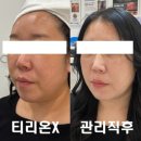 아미뷰티(AMI BEAUTY) | 대구 예신관리 모공 피부리프팅관리 온다 써마지 아미뷰티