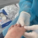 이노티안경구로항동점 | 구로ㅣ잘 자라지 않는 발톱 관리에 딱! 광명사거리 내성발톱 전문점 푸스케어 구로항동점 추천 찐 후기