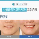 서울클리어치과교정과치과의원 이미지
