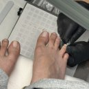 케아네일