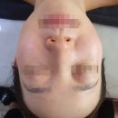 홍대속피부샵 추천 &#39;홍대쉬즈뷰티&#39;에서 동안얼굴 받은 후기