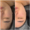 온아뷰티 | 두정동 피부관리실 ‘온아에스테틱’ 방문 후기 — 윤곽마사지 + LDM + 멀티이온플라즈마 관리까지 완벽...