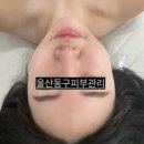 울산동구피부관리 피부보습 진정 에스테틱 &#39;샵곱다&#39;(#곱다)